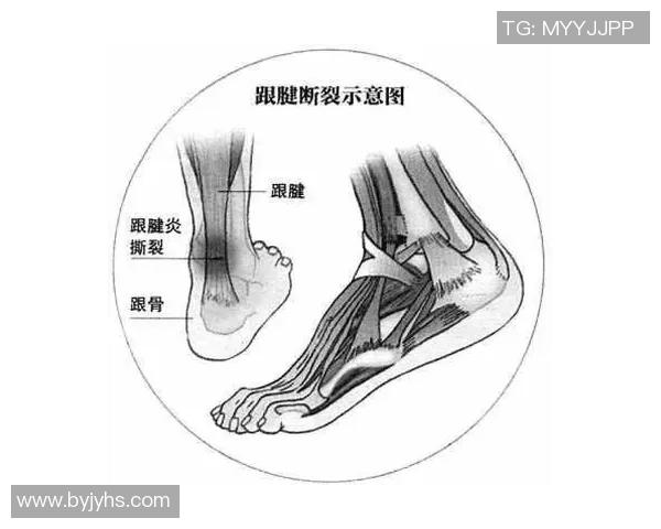 女单运动员伤病对比赛表现及职业生涯发展的深远影响分析 女单运动员伤病对比赛表现及职业生涯发展的深远影响分析